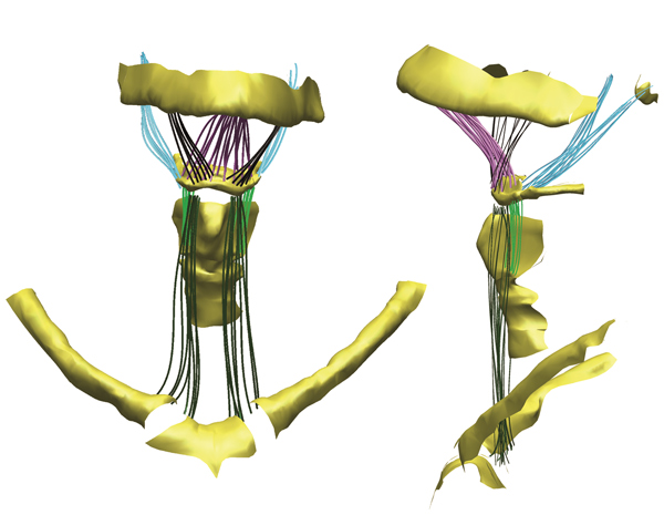 A 3D rendering of a human hyoid bone